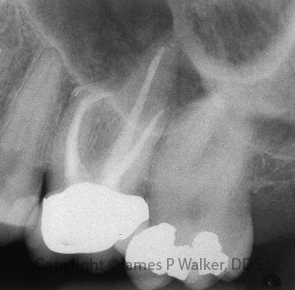 Molar